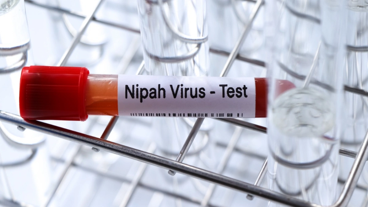 Nipah virusunu vaxtında müəyyənləşdirməyin yolları