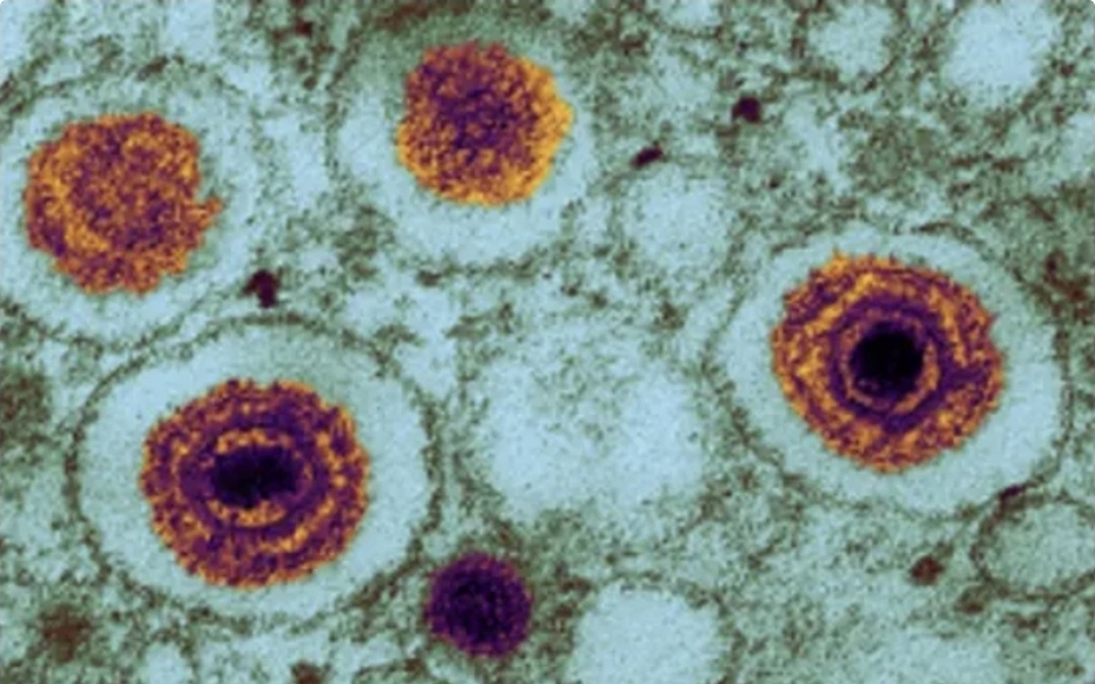 Alimlər yeni təhlükəli virus aşkarlayıblar